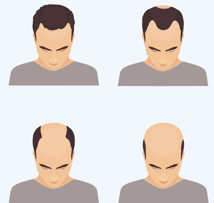 Восстановление волос на голове